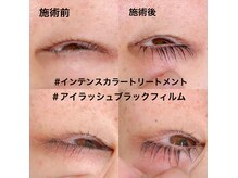 プラスメニューでアイリッドアップパーマをさらに進化させる