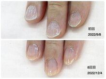 キアラネイル(Chiala nail)/自爪育成