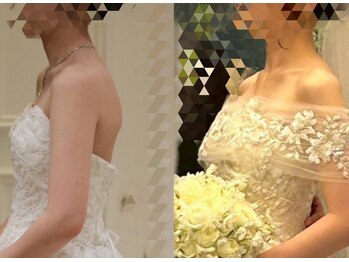 美骨矯正 ステキプロ(SUTEKI pro)/デコルテ・まき肩矯正ブライダル