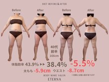 エテルナ(Eterna)/