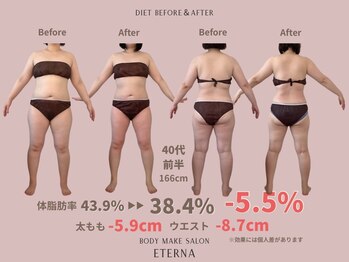 エテルナ(Eterna)/