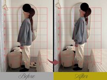 リン 大宮院(RIN)/骨膜整体での変化（担当：荒木）