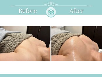 美人バスト 渋谷店/【バストアップ・育乳】◇症例◇