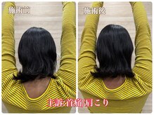 サロン ド ベトリー(Salon de Betory)/20代女性　主訴：肩こり/首痛