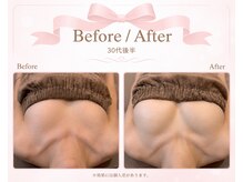 ロココ 安城店(Rococo)の雰囲気（丁寧なカウンセリング、お悩みに合わせた施術で確かな結果出し！）