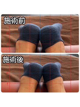 モリ(MORI)/施術のビフォーアフター