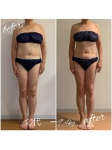 ヘルス＆ビューティークリニック　住美香（すみか）/四角いお腹がくびれました！