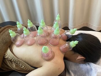 ゆるみ整体院/カッピング(吸い玉療法)