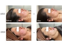 リクラ(Reclat)/ハーブ+モンテフェイス＆ヘッド