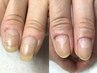 【爪先メンテ女性・手】深爪は卒業できたけど爪の手入れを続けたい方へ