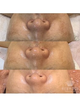 ビーカーブス 三鷹(B.curves)/before・after