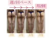 カルナ(CARNA)