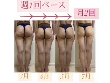 カルナ(CARNA)の写真