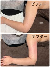 メディカルエステ ユウ(Yuu)/