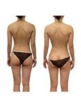 ベンザイ 新潟店(BENZAI)/肩甲骨ガチガチ