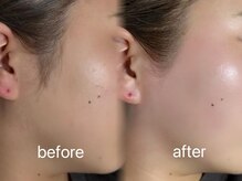 エファッセ 行田店(efface)/フェイスワックス♪