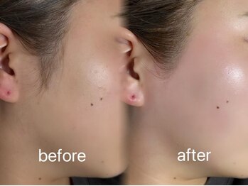 エファッセ 行田店(efface)/フェイスワックス♪