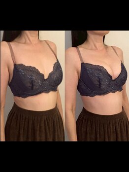 ヴィーナス(Venus)/バストケア