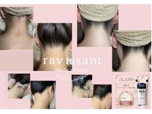 ラヴィソン(ravissant)の雰囲気（身体の内側からコラーゲン生成を促す、全身寝るだけエステ）