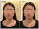 ナナラ鍼灸(NANALA鍼灸)の写真