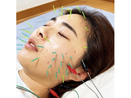 宮崎治療院の写真