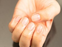 ニコルーム(Nico Room)/爪から健康ケア