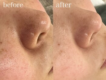 レア(Le’a)/フェイシャルWax