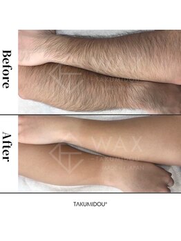 カイユウ(kaiyu)/メンズWAX(パーツ脱毛)