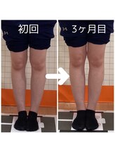 とくしま整体院 藍住院/O脚矯正