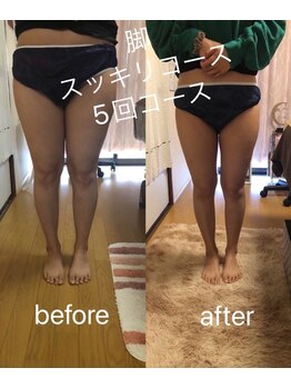 ナナラ(nanala)/脚スッキリコース