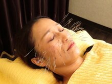 泰然の雰囲気（【鬼美容鍼】ほうれい線/シミしわ/たるみにお悩みの方にオススメ）