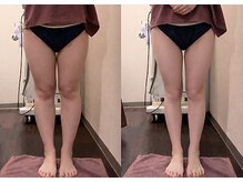 ラ パルレ 新宿本店の雰囲気(脚ケア/全身ボディケア/巡りサポート/引き締め/ブライダル)