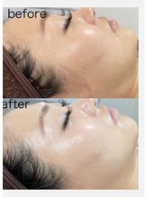 コア(Coeur)/【本格肌管理】オールハンド美肌