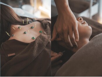 ヒノト(Hinoto)の写真/【根本改善で身体の軽い毎日を◎】身体のプロによる鍼灸施術で首肩こりや腰の重さがスッキリ！効果も継続◎