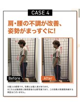 キンマク 本八幡駅前院(KINMAQ)/ビフォーアフター4