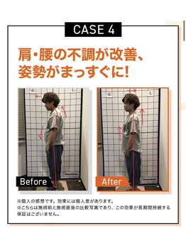 キンマク 本八幡駅前院(KINMAQ)/ビフォーアフター4