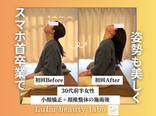 ルルラボ(LuLu beauty labo)の雰囲気（スマホ首にお悩みの方もお任せください。[小顔/スマホ首/整体]）