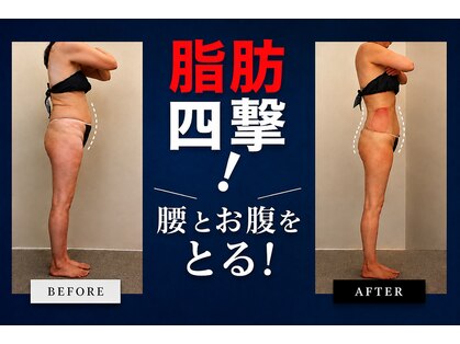 ボーテヌール(Beaute Nheur)の写真