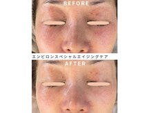 エミリエボーテの雰囲気（お客様に合ったコースをパーソナライズでご提案させて頂きます。）