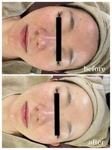 ジャスミン(Jasmin)/オーダーメイド高濃度原液導入