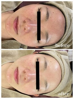 ジャスミン(Jasmin)/オーダーメイド高濃度原液導入