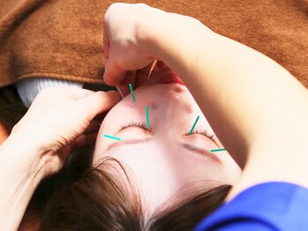 越谷ヘルム鍼灸整体院(越谷HELM鍼灸整体院)/美容鍼で張りのある肌に♪