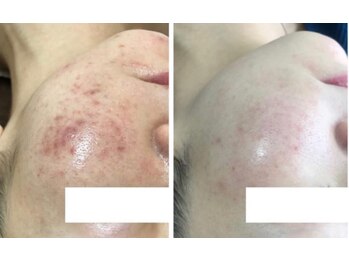 スリリアン 銀座/★お客さまビフォーアフター★