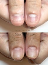マリーロール 梅田店(Marie Laure)/深爪改善/自爪育成/ネイルケア