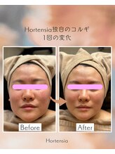 オルテンシア(Hortensia)/コルギ☆ビフォーアフター