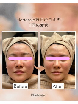 オルテンシア(Hortensia)/コルギ☆ビフォーアフター