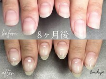 ツメハピ(tumehapi)の雰囲気（自爪育成8ヶ月後、爪育成ケアで爪の根本もととのい縦長の爪に！）