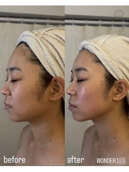 フロル(FLOR)/WONDER lift