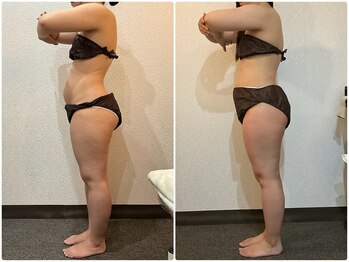 美容整体 ウェリナ 蟹江院/小顔矯正/骨盤矯正/痩身整体