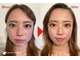 グレースフィオーレ 西宮北口店(gracefiore)の写真